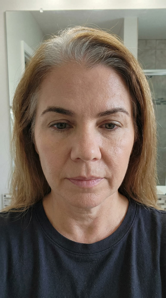 Antes